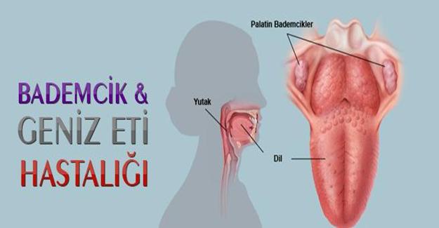 Bademcik ve geniz eti rahatsızlıkları hangi durumlarda tehlikeli