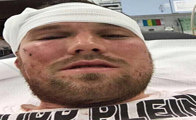 Alman basınından flaş iddia: "Grosskreutz'u hastanelik eden 16 yaşında bir Türk"