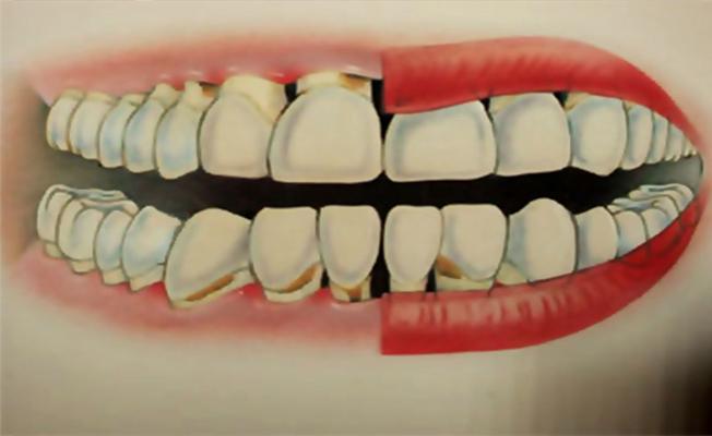 "Ağız ve diş hastalıkları fonksiyonel işlevleri negatif etkiliyor"
