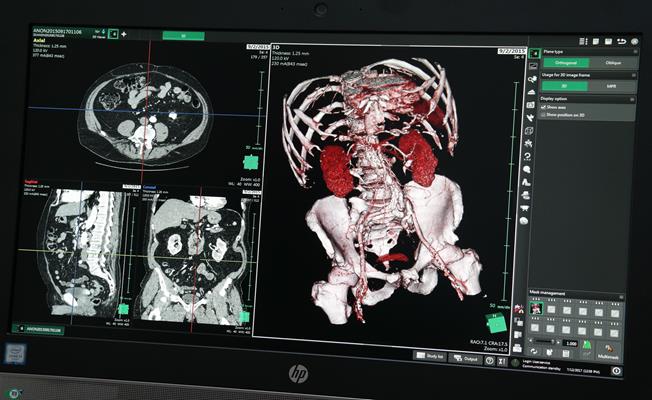 Radyolojide "3D'li yazılım" dönemi