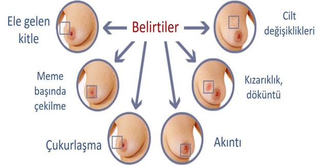 Meme Kanserinden Korkmamalısınız ! İşte Sebepleri