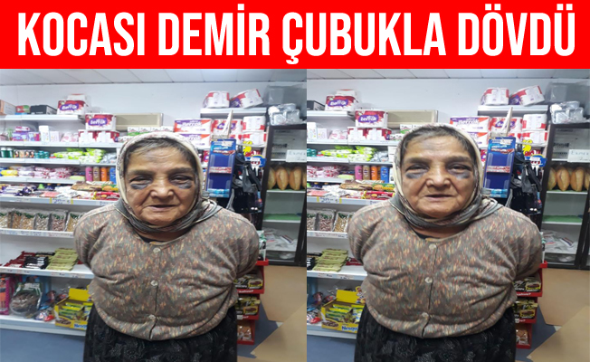 73 yaşındaki eşini demir çubukla dövdü