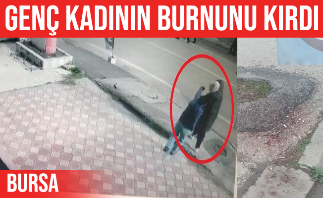 Bursa'da yolda yürüyen kadının burnunu kırdı