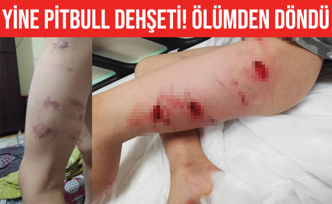 İzmir'de Pitbull dehşeti: Sahibi tasmayı bırakınca saldırdı