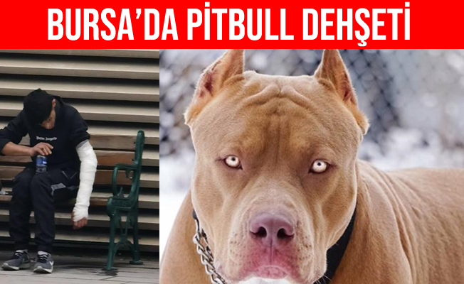 Bursa'da Pitbull dehşeti: çocuğun kolunu kopartıyordu
