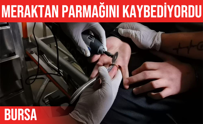 Bursa'da parmağına 1 TL sıkıştı