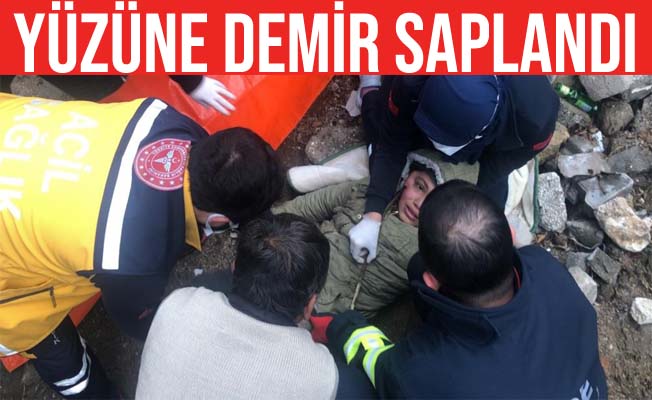 Niğde’de 10 yaşındaki çocuğun yüzüne demir saplandı