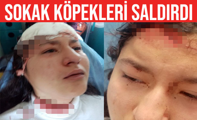 Öz çekim yaparken sokak köpeklerinin saldırısına uğradı