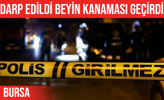 Bursa'da darp edilen avukat beyin kanaması geçirdi