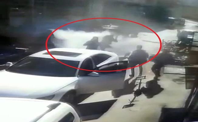 Sobadan sıçrayan alevler hastanelik etti