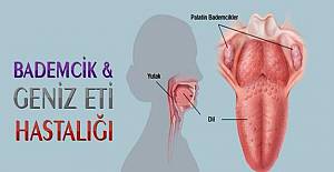 Bademcik ve geniz eti rahatsızlıkları hangi durumlarda tehlikeli