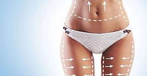 Lazer lipoliz teknolojisi ile kilo vermekten korkmayın