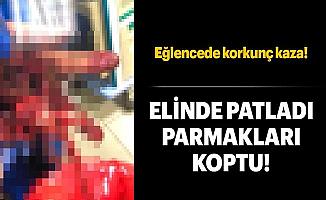 Asker Uğurlama Töreninde 3 Parmağı Koptu