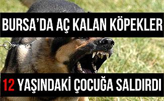 Bursa Yıldırım'da Köpekler 12 Yaşındaki Çocuğa Saldırdılar