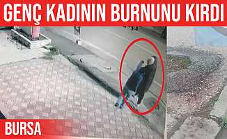 Bursa'da yolda yürüyen kadının burnunu kırdı