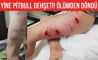 İzmir'de Pitbull dehşeti: Sahibi tasmayı bırakınca saldırdı