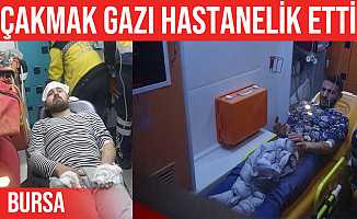 Patlayan çakmak gazı 2 kişiyi hastanelik etti